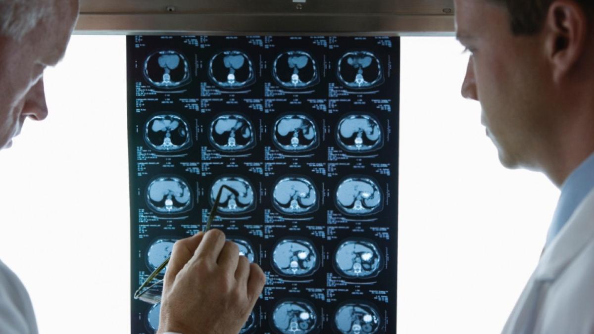 Inflammatory cytokines could be linked with depression, study shows